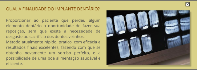 QUAL A FINALIDADE DO IMPLANTE DENTRIO?  Proporcionar ao paciente que perdeu algum elemento dentrio a oportunidade de fazer sua reposio, sem que exista a necessidade de desgaste ou sacrifcio dos dentes vizinhos. Mtodo atualmente rpido, prtico, com eficcia e resultados finais excelentes, fazendo com que se obtenha novamente um sorriso perfeito, e a possibilidade de uma boa alimentao saudvel e eficiente.