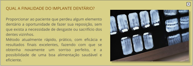 QUAL A FINALIDADE DO IMPLANTE DENTRIO?  Proporcionar ao paciente que perdeu algum elemento dentrio a oportunidade de fazer sua reposio, sem que exista a necessidade de desgaste ou sacrifcio dos dentes vizinhos. Mtodo atualmente rpido, prtico, com eficcia e resultados finais excelentes, fazendo com que se obtenha novamente um sorriso perfeito, e a possibilidade de uma boa alimentao saudvel e eficiente.